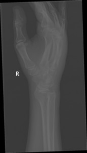 Hand X-Rays Thailand